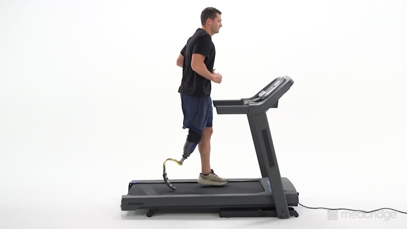 Running With a Prosthesis