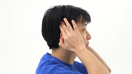 Temporalis Mobilization